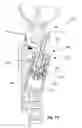 Fig. 11 - PROSTHETIC WITH VOICE COIL VALVE