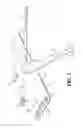 Fig. 02 - APPARATUS AND METHOD FOR SUSPENDING RESIDUUM PROTECTION DEVICE