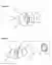 Fig. 04 - Hydro-block air vent condom catheter and method of use
