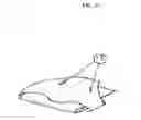 Fig. 22 - One piece ostomy pouch enhancements