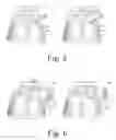 Fig. 04 - WhipFlash [TM]: wearable environmental control system for predicting and cooling hot flashes