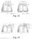 Fig. 08 - WhipFlash [TM]: wearable environmental control system for predicting and cooling hot flashes