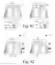 Fig. 22 - WhipFlash [TM]: wearable environmental control system for predicting and cooling hot flashes