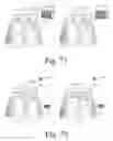 Fig. 37 - WhipFlash [TM]: wearable environmental control system for predicting and cooling hot flashes