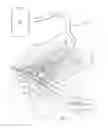 Fig. 02 - Dressing with contracting layer for linear tissue sites