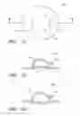 Fig. 09 - Wound dressing and method of use
