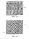 Fig. 17 - Wound dressing and method of use
