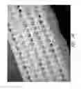 Fig. 18 - Wound dressing and method of use