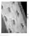 Fig. 19 - Wound dressing and method of use