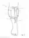 Fig. 05 - POST-SURGICAL DRAIN MANAGEMENT GARMENT