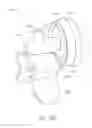 Fig. 52 - Pressure-regulating vial adaptors