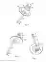 Fig. 02 - NURSING BOTTLE NIPPLE AND AIR-VENTING SYSTEM