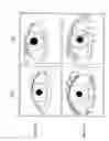 Fig. 02 - METHOD OF ENHANCING HAIR GROWTH