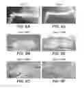Fig. 07 - Methods For Bone Treatment By Modulating An Arachidonic Acid Metabolic or Signaling Pathway