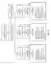 Fig. 52 - DPA-enriched compositions of omega-3 polyunsaturated fatty acids in free acid form