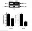 Fig. 03 - METHODS AND COMPOSITIONS FOR TREATING CANCER