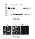 Fig. 07 - Neuronal pain pathway