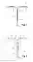 Fig. 02 - COPPER INTRAUTERINE DEVICE