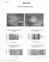 Fig. 05 - Methods of maintaining fat volume