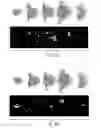 Fig. 06 - METHODS FOR PERFORMING A CORONARY ARTERY BYPASS GRAFT PROCEDURE