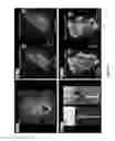 Fig. 03 - System and Method for Modulation of Cardiac Tissue