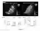 Fig. 04 - System and Method for Modulation of Cardiac Tissue