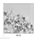 Fig. 05 - Process for making iron oxide nanoparticle preparations for cancer hyperthermia