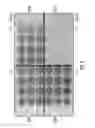 Fig. 17 - Process for making iron oxide nanoparticle preparations for cancer hyperthermia