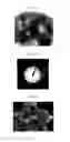 Fig. 05 - Radioactive nanoparticles and methods of making and using the same