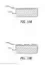 Fig. 06 - Drug eluting expandable devices