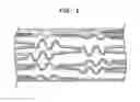 Fig. 02 - STENTS HAVING BIODEGRADABLE LAYERS