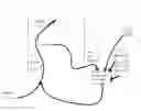Fig. 01 - Method and apparatus for mitigating acute reoxygenation injury during percutaneous coronary intervention