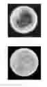 Fig. 08 - Filter device combining beads and fibers