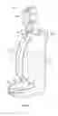 Fig. 08 - PORTABLE INTRAVENOUS (IV) BACKPACK