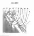 Fig. 10 - RETAINING DEVICE FOR HOLDING ITEMS ON A HOSPITAL BED FRAME