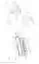 Fig. 02 - Infusion pump system and methods