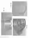 Fig. 07 - Child-resistant closure systems for containers