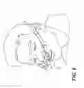Fig. 08 - NASAL INTERFACE AND REMOVABLE PAD THEREFOR