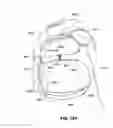 Fig. 129 - PAP system