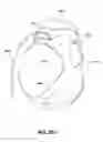 Fig. 44 - PAP system