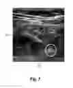 Fig. 07 - STERILE LIQUID DELIVERY SYSTEM AND METHOD
