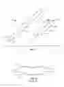 Fig. 02 - BALLOON CATHETER WITH IMPROVED COLUMN STRENGTH AND TORQUE TRANSMISSION