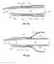Fig. 04 - BALLOON CATHETER WITH IMPROVED COLUMN STRENGTH AND TORQUE TRANSMISSION