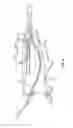 Fig. 04 - CATHETER ACCESS AND CONTROL DEVICE AND METHOD OF USING SAME
