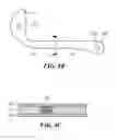 Fig. 09 - Catheter connection and stabilization device and methods of using same