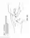 Fig. 13 - Catheter connection and stabilization device and methods of using same