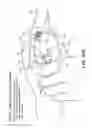 Fig. 14 - Catheter connection and stabilization device and methods of using same