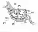 Fig. 01 - Corewire design and construction for medical devices