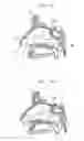 Fig. 02 - Corewire design and construction for medical devices