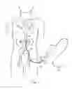 Fig. 02 - System and method for traversing an arterial occlusion